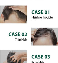 Dashu Daily Anti - Hair Loss Herb Hair Tonic - 150ML